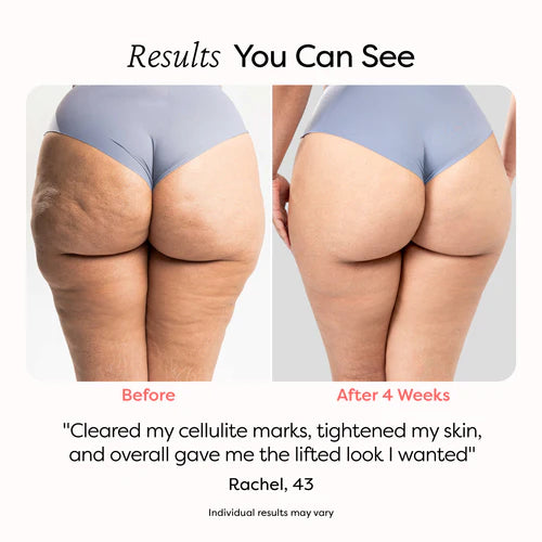 Redumae Sculpt Device
